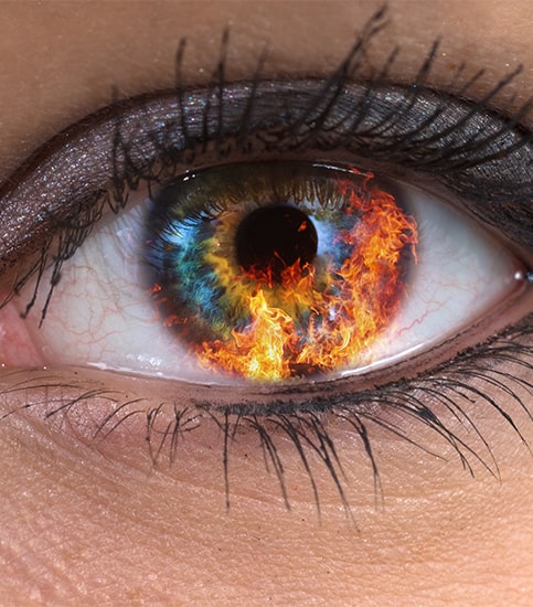 Термический ожог глаза: первая помощь и лечение