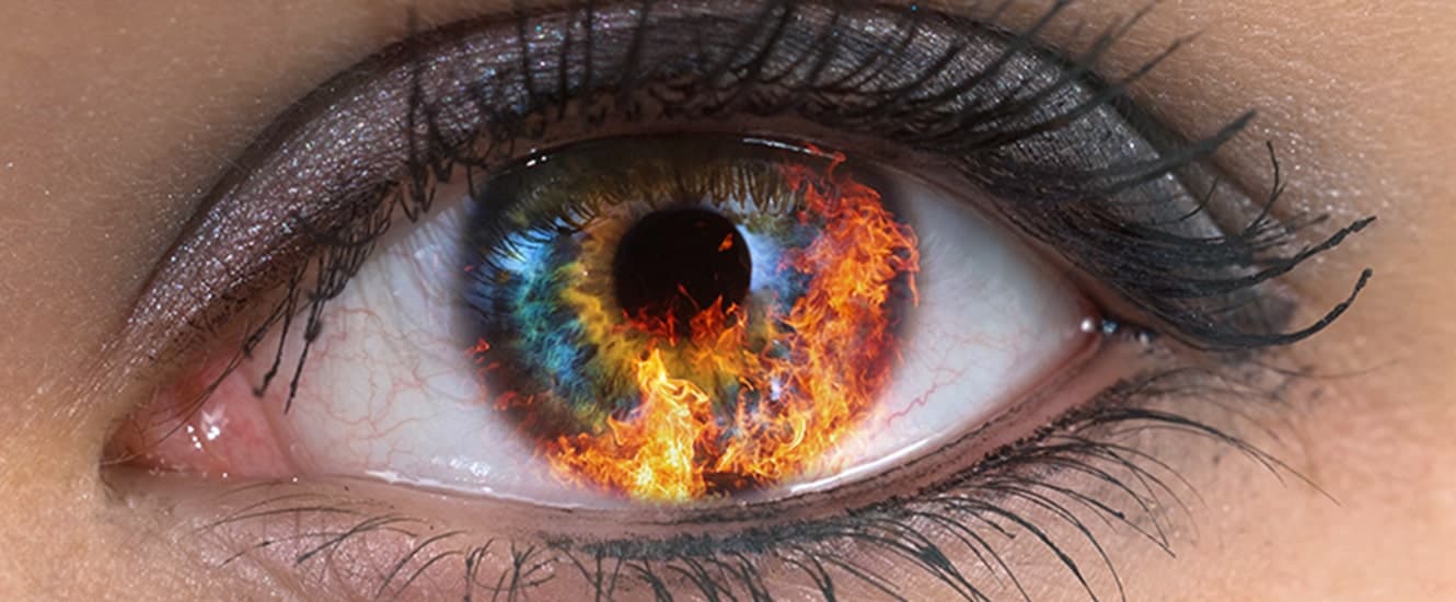 Термический ожог глаза: оказание первой помощи, степени ожога и лечение
