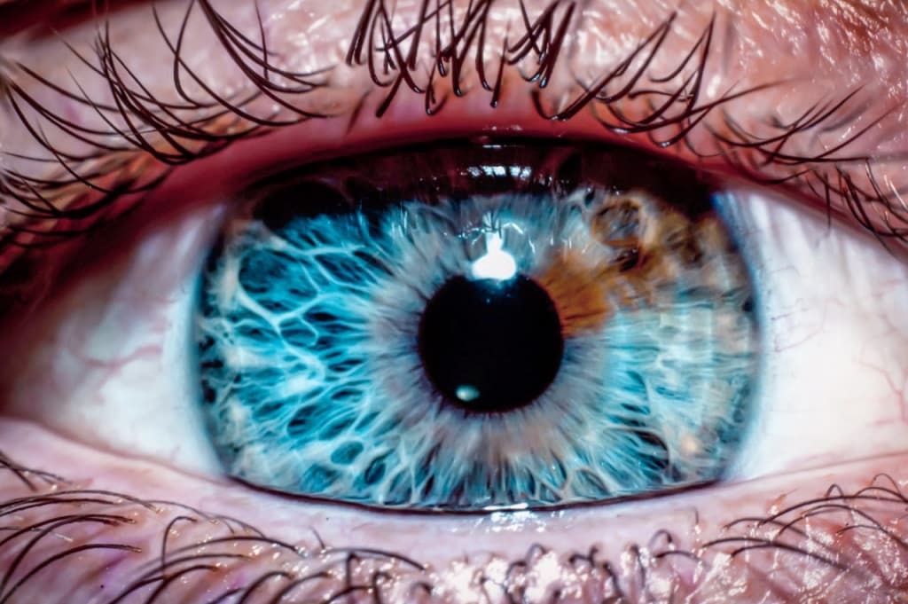 Гетерохромия глаз у людей: что означает и опасно ли это